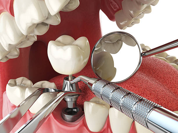 Best Knocked-Out Tooth Emergency  in New Egypt, NJ